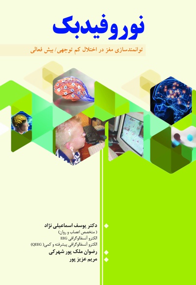 نوروفیدبک