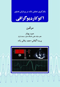 اکوکاردیوگرافی