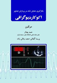 اکوکاردیوگرافی