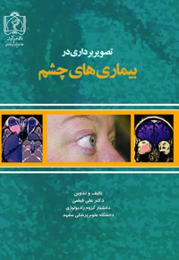 تصویربرداری در بیماری های چشم - نویسنده: علی فیضی - ناشر: دانشگاه علوم پزشکی مشهد