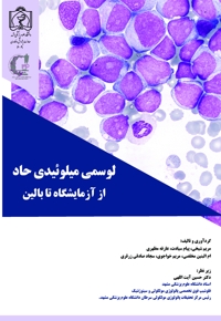 لوسمی میلوئیدی حاد: از آزمایشگاه تا بالین