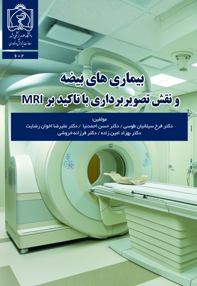 بیماری های بیضه و نقش تصویربرداری با تاکید بر MRI