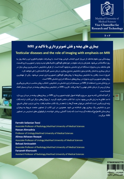 بیماری های بیضه و نقش تصویربرداری با تاکید بر MRI
