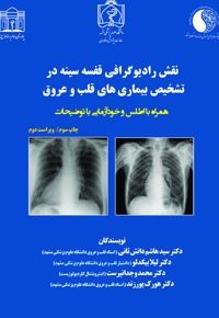 نقش رادیوگرافی قفسه سینه در تشخیص بیماریهای قلب و عروق