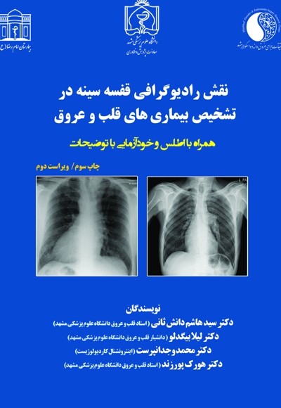 نقش رادیوگرافی قفسه سینه در تشخیص بیماریهای قلب و عروق