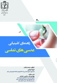 راهنمای کلینیکی عدسی های تماسی