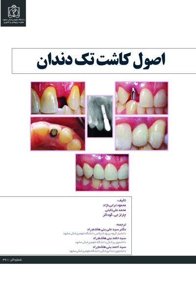 اصول کاشت تک دندان - ناشر: دانشگاه علوم پزشکی مشهد  - نویسنده: محمود ترابی نژاد