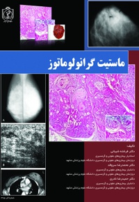 ماستیت گرانولوماتوز - ناشر: دانشگاه علوم پزشکی مشهد  - نویسنده: ماستیت گرانولوماتوز
