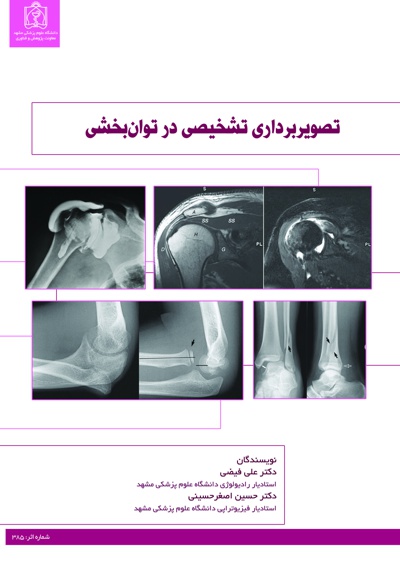تصویربرداری تشخیصی در توان بخشی - ناشر: دانشگاه علوم پزشکی مشهد  - نویسنده: علی فیضی