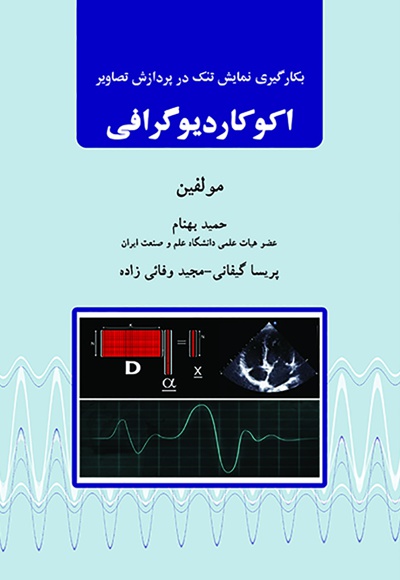اکوکاردیوگرافی اکوکاردیوگرافی -